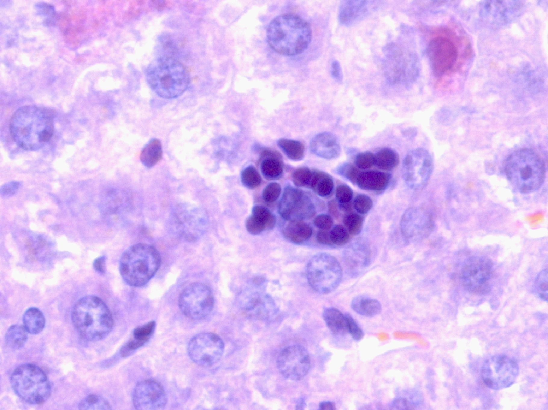 ������� 2 � ������ ����� ��� ������ ����������� ��������