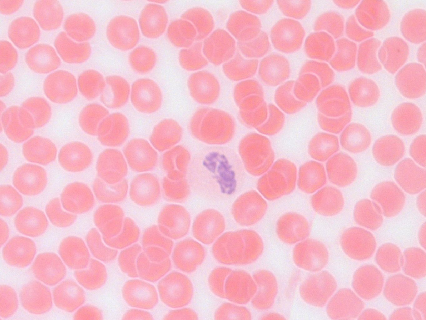 ������� 25 - �������������� ���������. ���� ��� ������������ ������������ ������ ��������, ��� ��� ���� ����� ��� ��������� �������