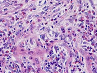 ������� 1 � ������ ������� ��� ������������ ���������