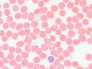 ������� 17 � ����� ��������