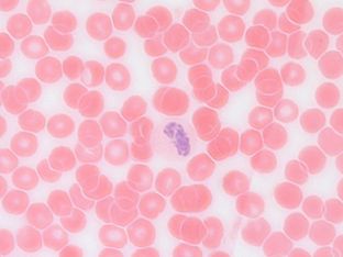 ������� 25 - �������������� ���������. ���� ��� ������������ ������������ ������ ��������, ��� ��� ���� ����� ��� ��������� �������