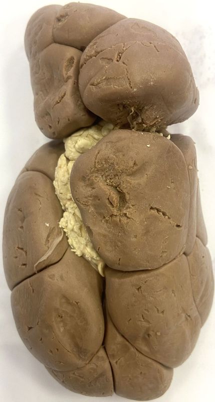 ���. 11. ����������� ��������������� ����� �������� �������� ����� (������ �����)