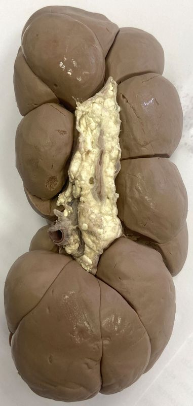 ���. 11. ����������� ��������������� ����� �������� �������� ����� (����� �����)