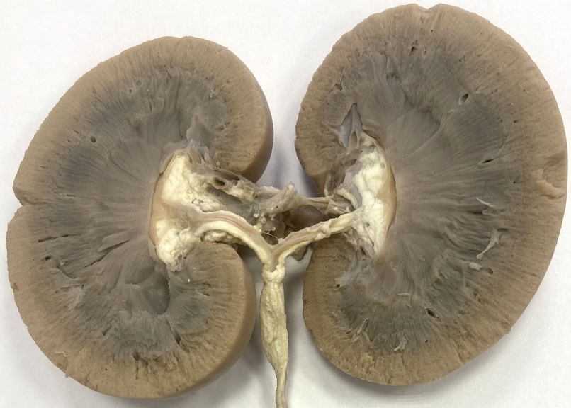 ���. 32. ������� �������������� ����� ����