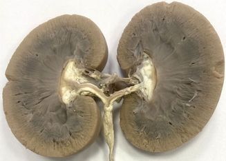 ���. 32. ������� �������������� ����� ����