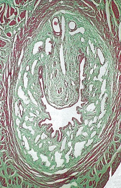 ���. 19. ��������������� �������� ����������������� ������