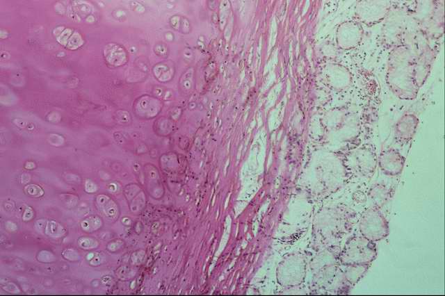 ������������ ��������� � �������� ������