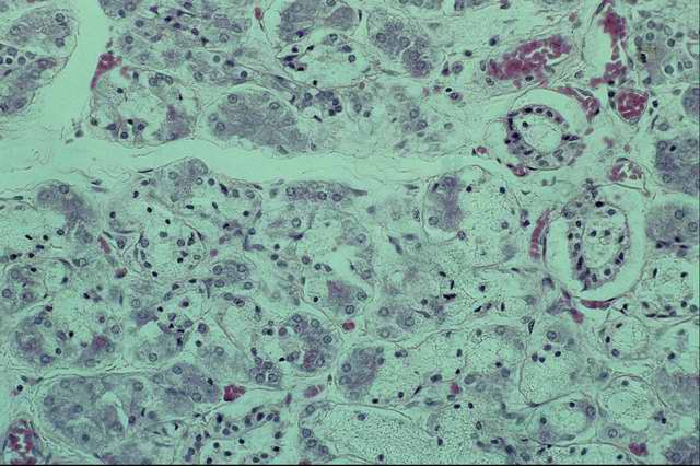 ������������� ���������� � ���� ��������� ��������� (������� ������)