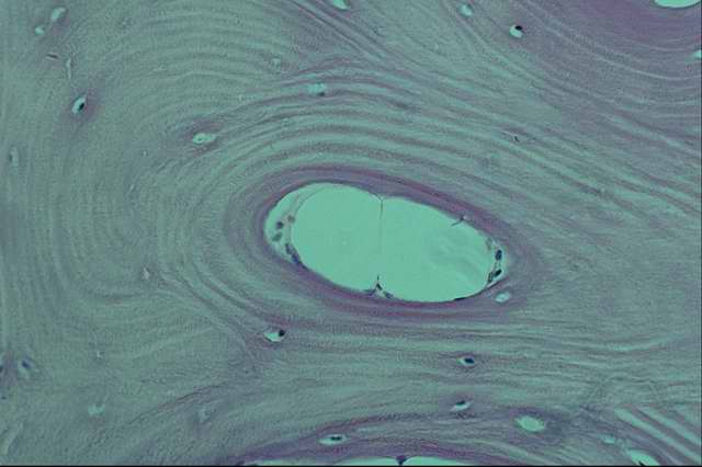 ��������� ���������� (���������� ��������� �����)