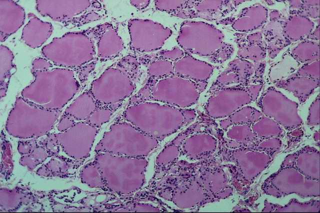 ������������ ���������� ������ (���������� ���)