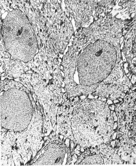 n39.jpg (70851 bytes)